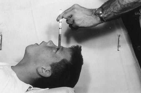 الطفل Howard Dully صاحب الـ12 عاما وهو يعالج بالشق على يد الطبيب الامريكي فريمان عام 1960